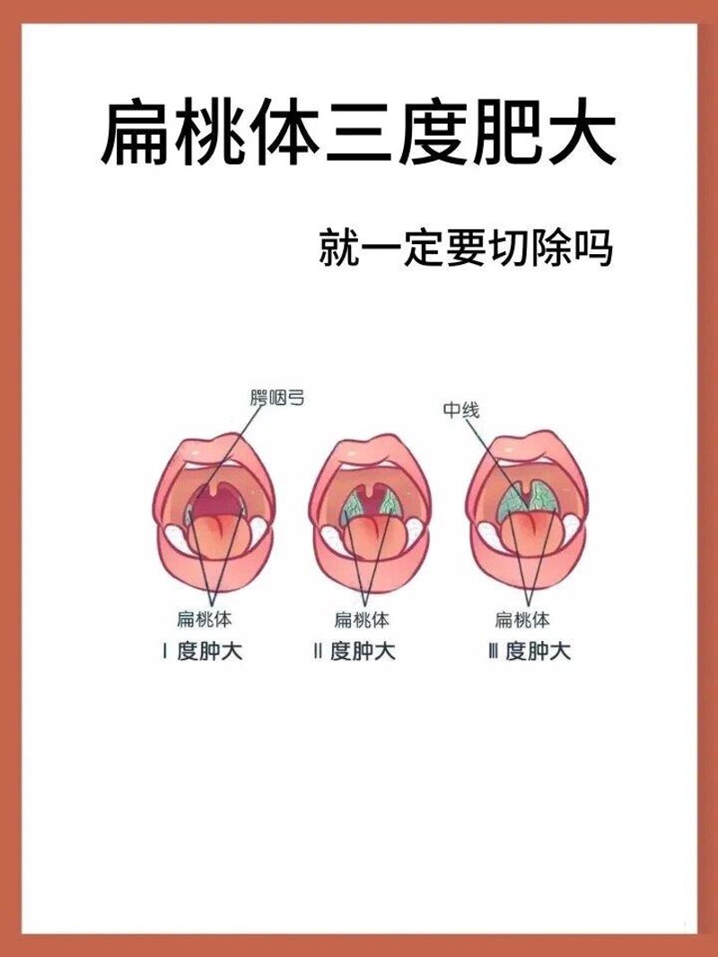 耳鼻喉专科护理工作的酸甜苦辣