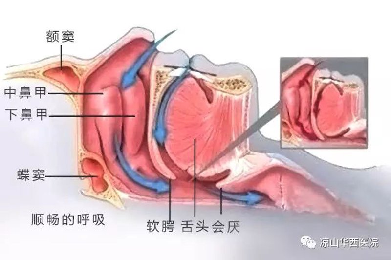 凉山咽喉炎治疗
