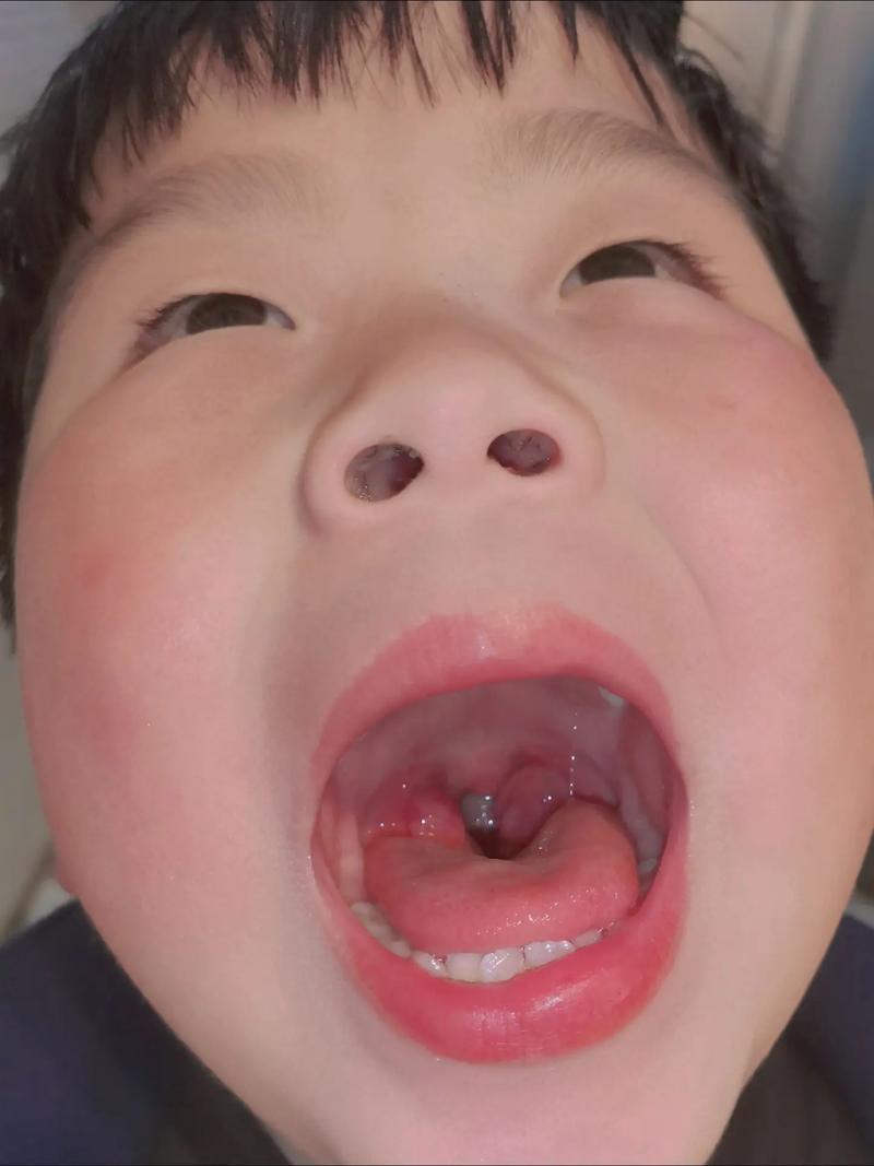 耳鼻喉专科护士的心得体会